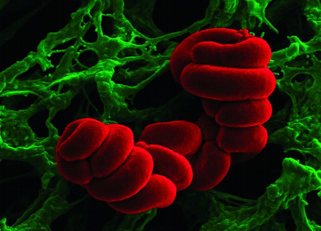 Scanning Electron Micrograph of Listeria by Roy D. Sleator, with colour added by Mr. Pat Casey, AP | Boundary Work I | Friday 12 November  – Saturday 27 November 2010 | CIT Wandesford Quay Gallery