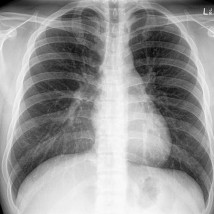 Phoenix Rising: Art and Civic Imagination |   | Friday 7 November 2014 to Sunday 29 March 2015 | to 