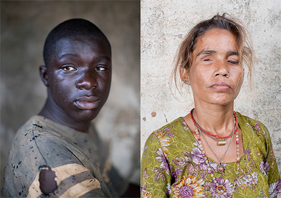 © Graeme Robertson / Sightsavers | Graeme Robertson: Framing Perceptions – a Sightsavers exhibition | Wednesday 24 February  – Sunday 6 March 2016 | Photo Museum Ireland