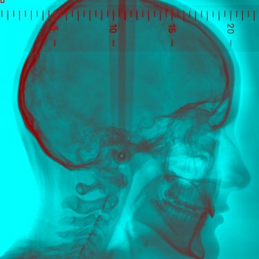 The School of Looking: Invisible Light |  Crawford Art Gallery 
Emmet Place, Cork | Wednesday 7 October to Sunday 29 November 2020 | to 