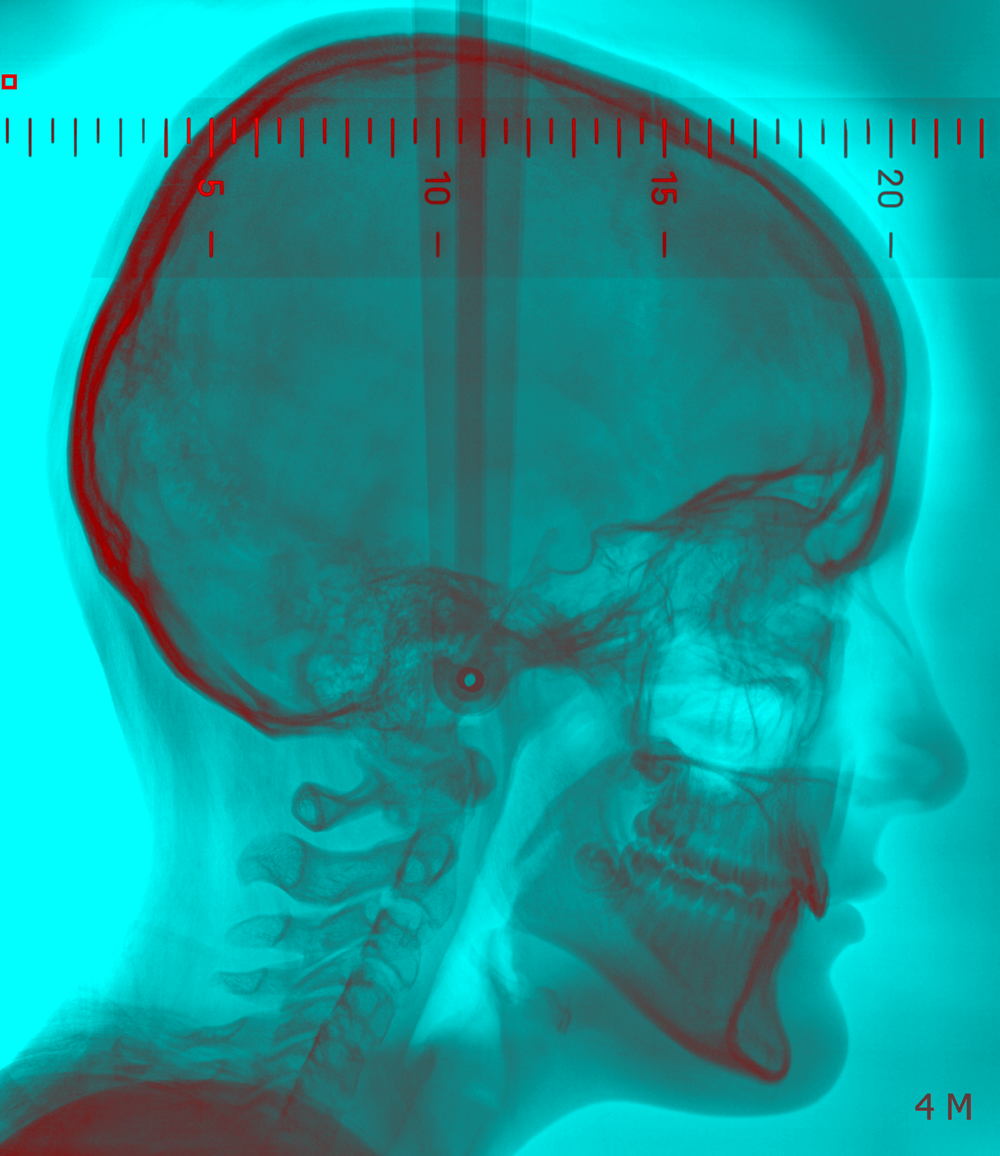 The School of Looking, I Can See Right Through You (detail), 2020, mixed media. © The School of Looking | The School of Looking: Invisible Light | Wednesday 7 October  – Sunday 29 November 2020 | Crawford Art Gallery