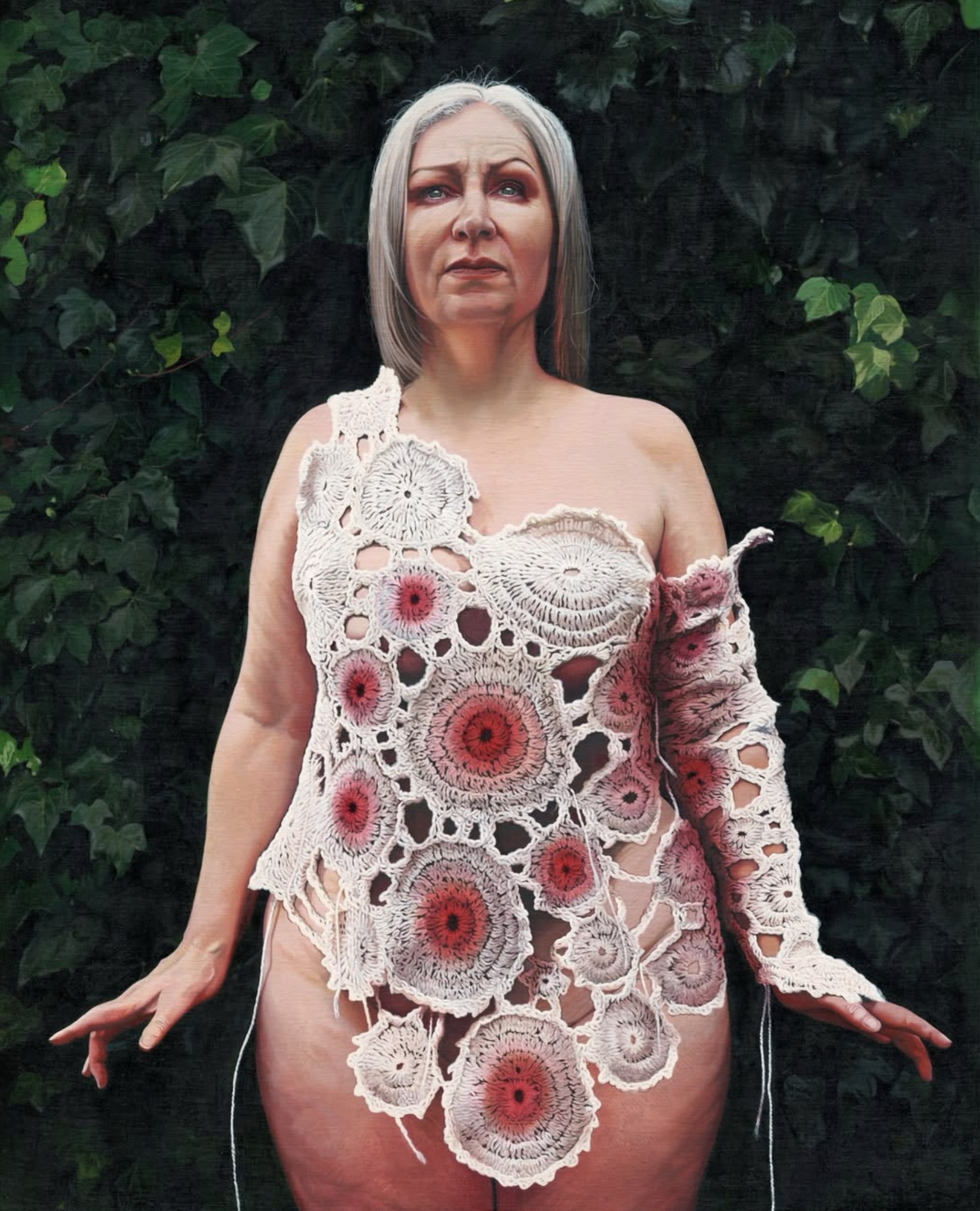 Jackie Hudson Lalor: A Chronic Pain | SURVEYOR 2025 | Saturday 15 November  – Saturday 20 December 2025 | Solstice Arts Centre | Image: Jackie Hudson Lalor: A Chronic Pain | it is hard to be certain whether this is a painting or a photo; we see the upper two-thirds of a body lightly clad in a ‘blouse’ that consists of doilies of a few sizes sewn together with gaps; many of the doilies redden from white towards their middle, presumably depicting pain; behind the figure is a wall of ivy 